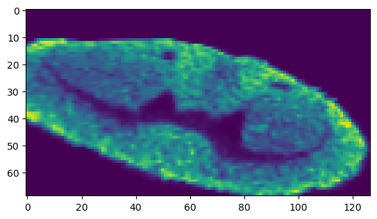 _images/Tutorial_1:_Data_pre-processing_for_SMA_data_18_2.png